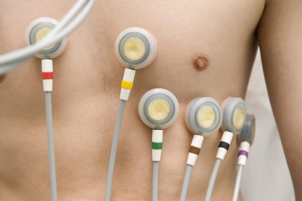 elektrody przyczepione do klatki piersiowej młodego mężczyzny